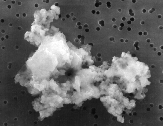 dust particles under microscope